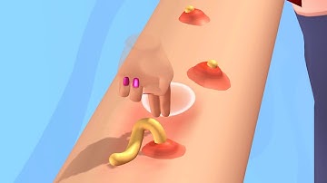 ‎Acne ASMR - All Levels Gameplay Android, iOS