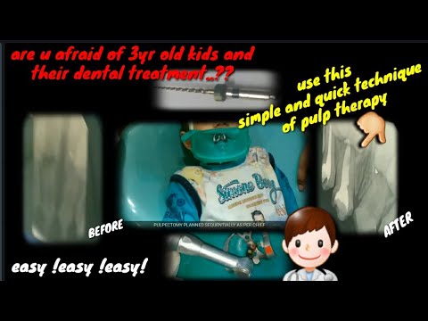 Stage 3 Rct how to do rct in a 3 year child | step by step - YouTube