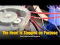 POV: Going on the Heart-Lung Machine | Perfusionist Explains Cardiopulmonary Bypass