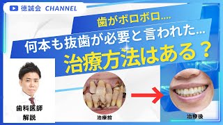 短期集中治療 – 川崎ルフロン歯科 川崎駅徒歩3分/土日祝年中無休/20時