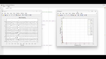 How to Analyze and Plot Power Spectral Density (Welch’s Method) from EEG Signal Using MATLAB