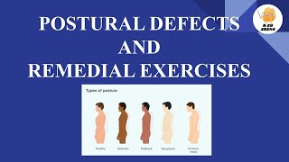 Postural Defects | Remedial Exercises | Physical Education Notes | B.Ed. Notes