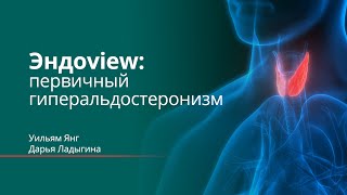 Эндоview: первичный гиперальдостеронизм. Уильям Янг, Дарья Ладыгина