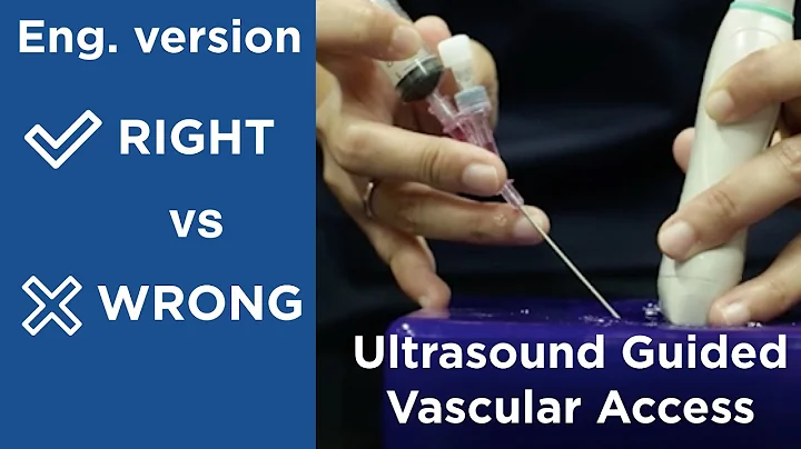 How to perform Short axis vascular access like expert(English version)