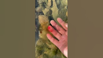 Stop bleeding from finger wounds