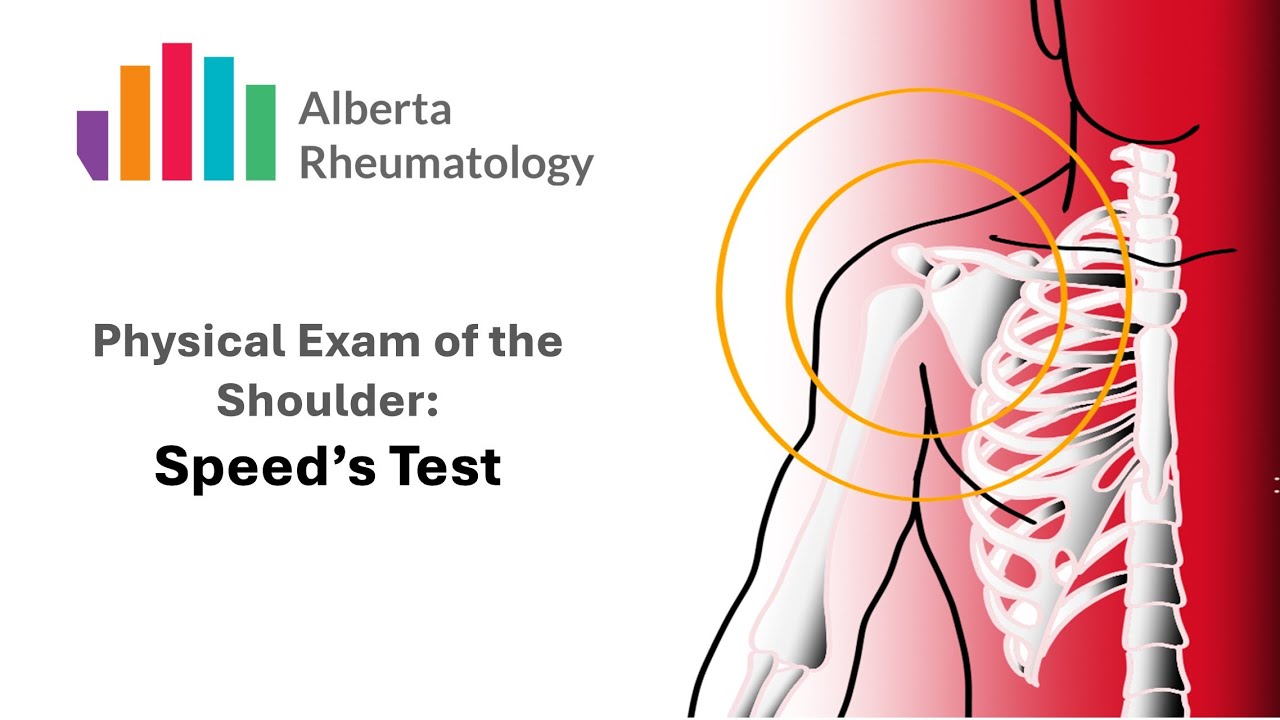 Speed's Test: Rheumatology Shoulder Physical Exam Special Tests - YouTube