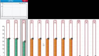 Measuring eSRT for MedEL cochlear Implants