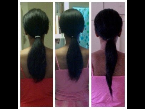 Side effects of equate hair regrowth treatment