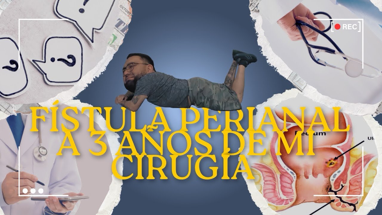 Fístula perianal a 3 años de mi cirugía ahora la vesícula noooooo!!!!!! @torovlog08