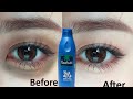 Just apply 1 night and Get rid of dark circles naturally | Permanent solution of dark circles