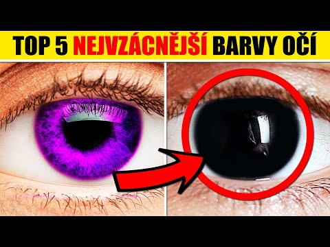 Video: Jak vzácné jsou dvě různé barvy očí?