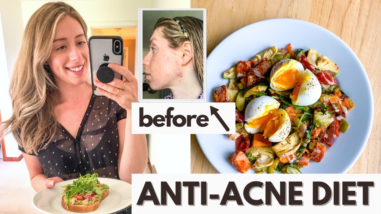 Anti Acne Diet What I Eat In A Day For Hormonal Acne YouTube