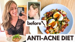 AntiAcne Diet: What I Eat in a Day for Hormonal Acne