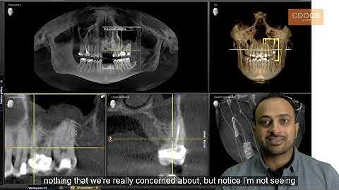 Tip of the Day: 2D vs 3D Imaging
