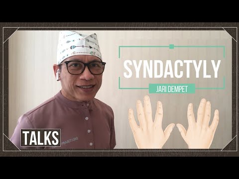 Jari dampit Sindaktili - TALKS with  Dr. Teddy