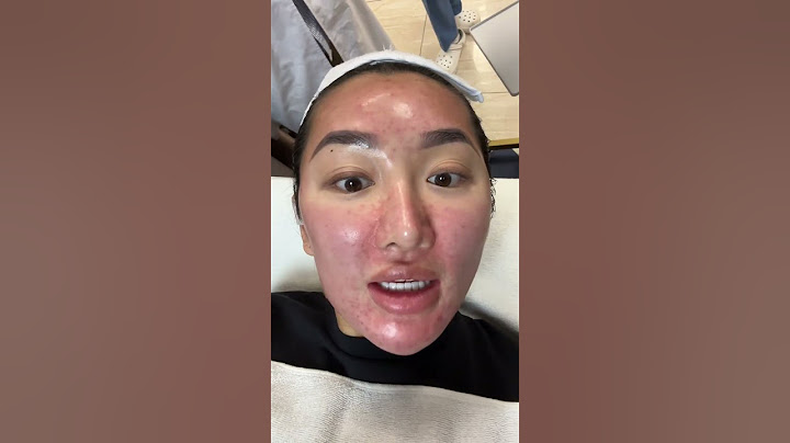 12 LASER SKIN TREATMENTS IN KOREA✨👀