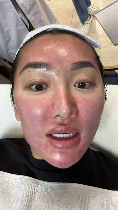 12 LASER SKIN TREATMENTS IN KOREA✨👀