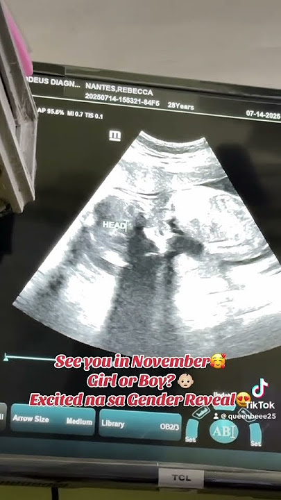 Gender Reveal Soon 🩷💙 Excited na ang Mommy at Daddy malaman gender mo anak 🤭😍😘 #ytviral #yt