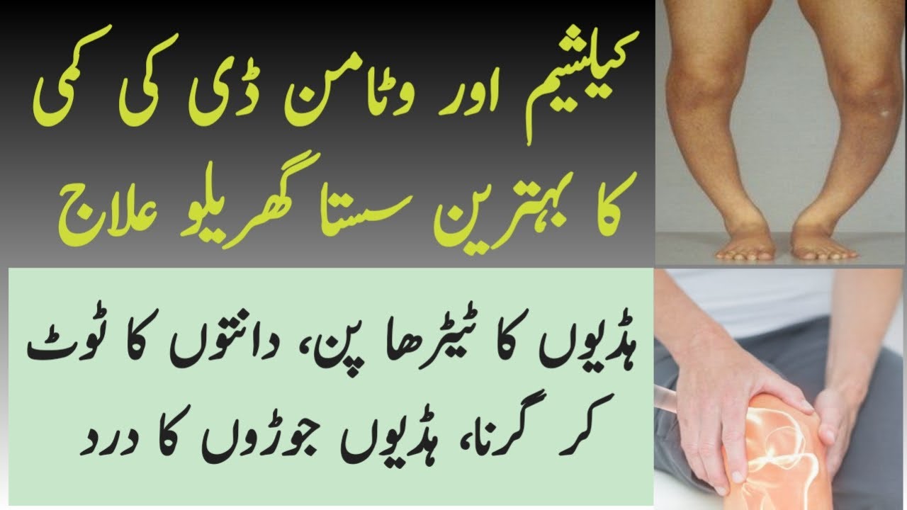 Calcium Or Vitamin D Ki Kami Ko Pora Karne Ki Tips / Tips to increase