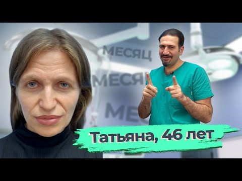 Омоложение Лица, Ринопластика, Липофиллинг Подбородка: Татьяна, 46 Лет