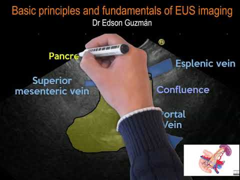 BASICS IN EUS: Basic principles and fundamentals of EUS imaging
