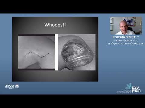 Soft Tissue Tumors - Dr. Amir Sternheim