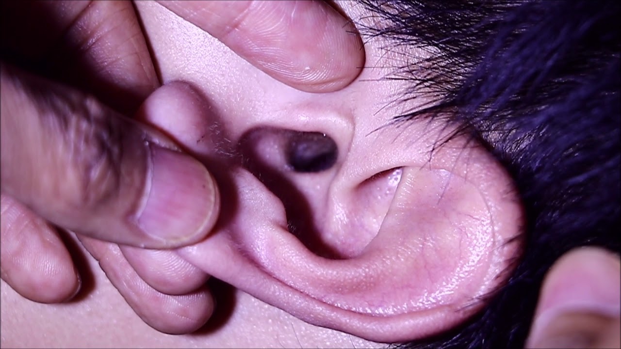 ASMR ear cleaning แคะหูคนหล่อโคตรยาก1 YouTube
