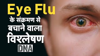 DNA LIVE: कंजंक्टिवाइटिस का वायरल DNA टेस्ट | Eye Flu Cases Increase In India | symptoms|treatment