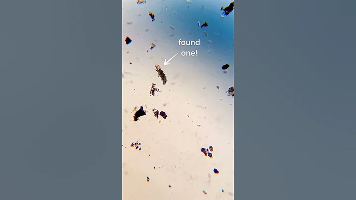 How to find water bears 🐻 #tardigrades #waterbears #microscope #microscopy