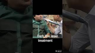 Laser treatment is effective for lip melanosis, using Q-switched Nd:YAG picosecond lasers