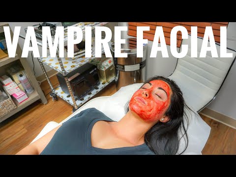 Vampire Facial: PRP Microneedling