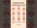 Tongue Colors That Indicate Health Issues Health Awareness Healthylifestyle Healthyeating