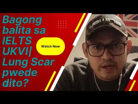 Bagong balita tungkol sa IELTS UKVI | Lung Scars pwede ba dito? | May intro at outro na c Dodong