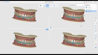 Medit Ortho Simulation 1.1 screenshot 4