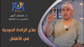 علاج الزائدة الدودية في الأطفال - دكتور محمد أنس