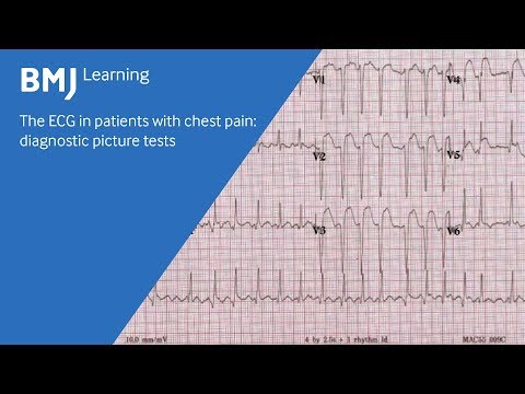 Video: Hvordan gjenkjenne et hjerteinfarkt (med bilder)