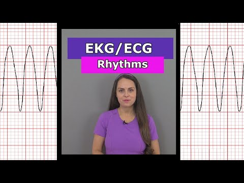 Video: Sinusrhythmus-Arrhythmie?