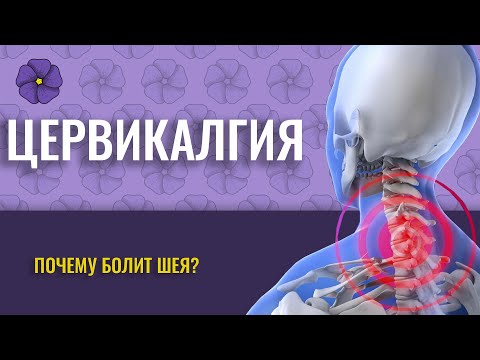 ЦЕРВИКАЛГИЯ. ПОЧЕМУ БОЛИТ