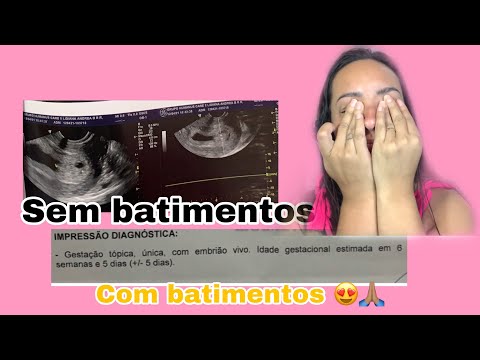 Do aborto Retido