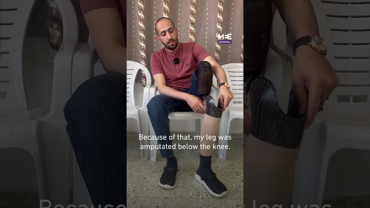 'I was a test subject to them’ Palestinian detainee lost his leg inside an Israeli prison