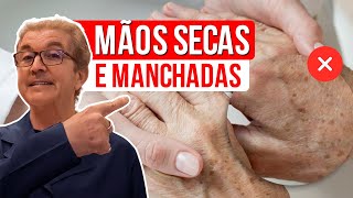 #1 Melhor Remédio Absoluto para Mãos Secas e Enrugadas