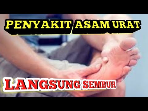 Ramuan ampuh Cara mengobati asam urat  secara alami 