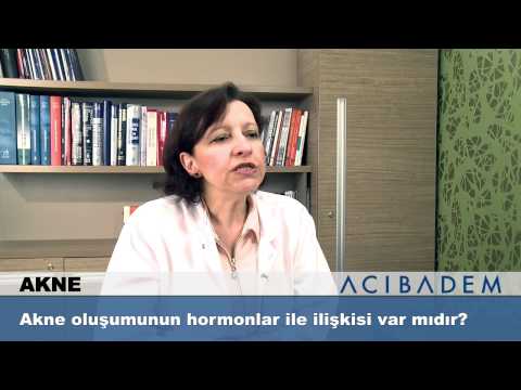 Akne oluşumun hormonlar ile ilişkisi var mıdır?