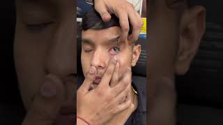 Lens lagane ka sahi tarika #shortsfeed #opticalillussion #contectlens #eyedoctor #opticalvision #