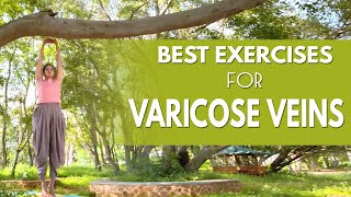 Varicose Veins Exercise | Varicose Veins Treatment | Manthena Satyanarayana Raju Latest Videos