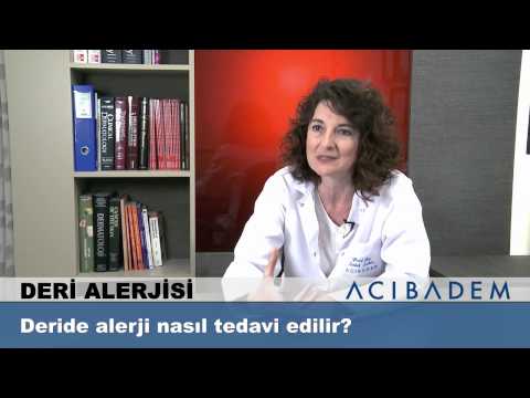 Video: Isı Döküntüsü Nasıl Tedavi Edilir: 14 Adım (Resimlerle)