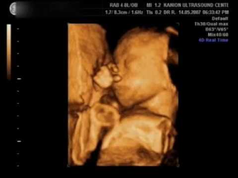 23rd week 4D Ultrasound - Amazing!
