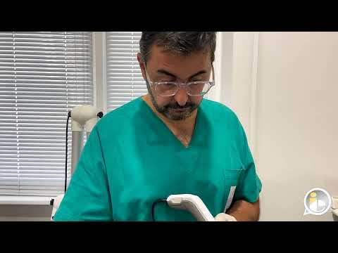 Ringiovanimento cutaneo con Dermapen: Dimostrazione | Dott. Pasqualino Savo