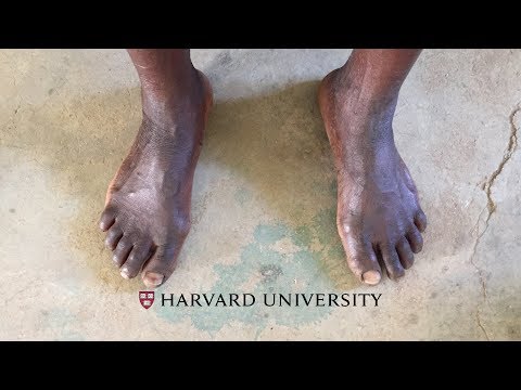 Barefoot walking thumbnail