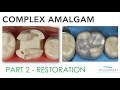 COMPLEX AMALGAM PART 2: RESTORATION